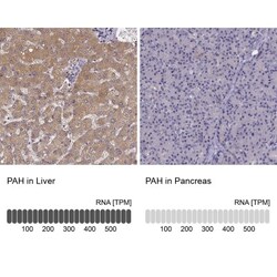 Phenylalanine Hydroxylase Antibody, Novus Biologicals:Antibodies:Primary